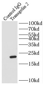 TEX14 antibody|TEX14抗体