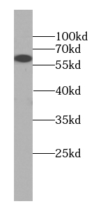 FIZ1 antibody|FIZ1抗体 FNab02508