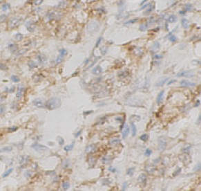 NPC2 antibody|NPC2抗体 FNab10049