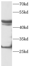 PDGFD antibody|PDGFD抗体