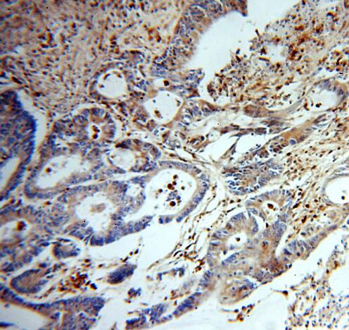 TYMP antibody|TYMP抗体