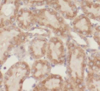 PPID antibody|PPID抗体 FNab09977