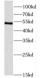 CORO2B antibody|CORO2B抗体