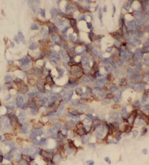 BLOC1S6 antibody|BLOC1S6抗体