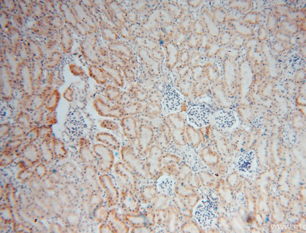RNLS antibody|RNLS抗体 FNab07239