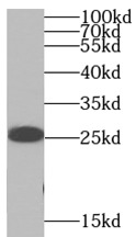 SNAP25 antibody|SNAP25抗体 FNab0