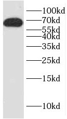HNF1A antibody|HNF1A抗体