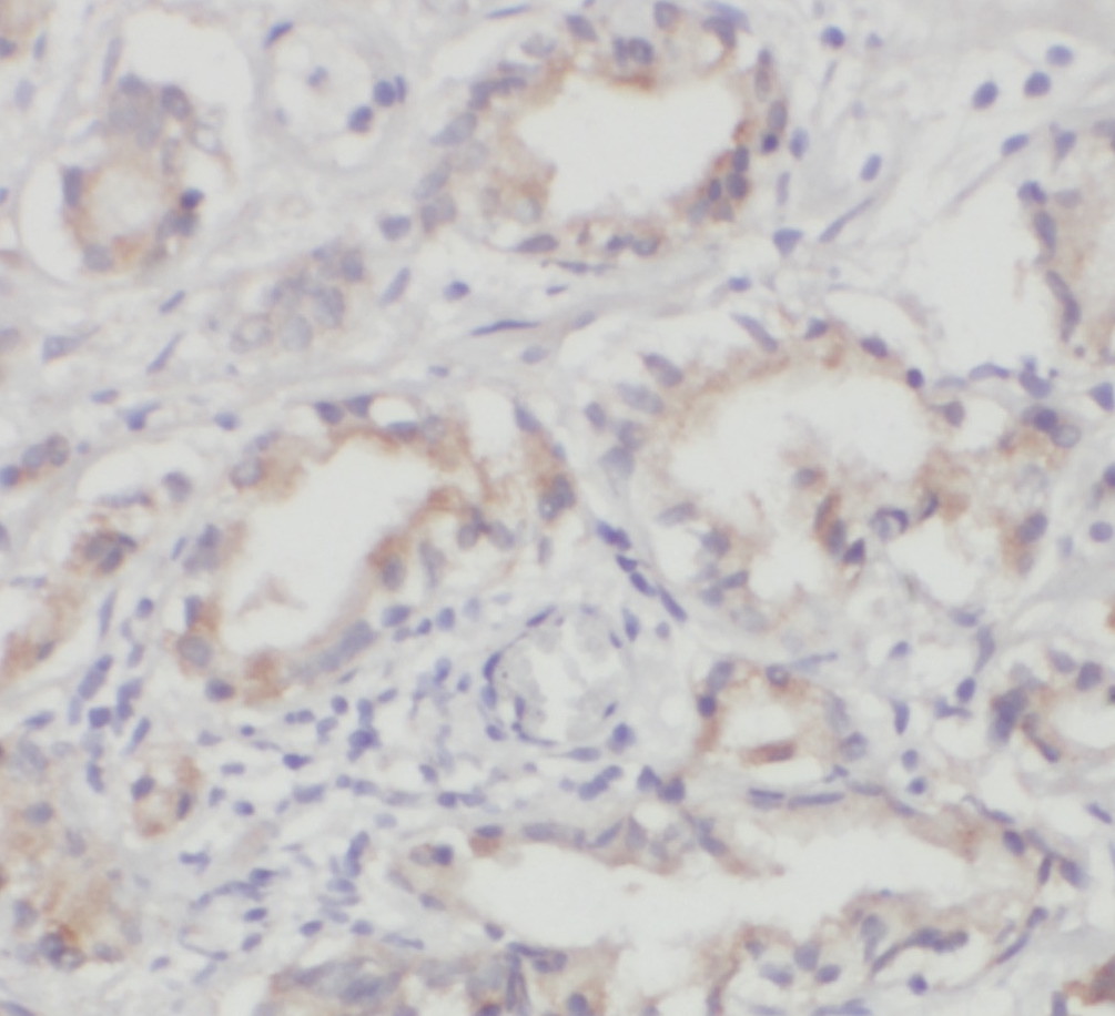 PARVA antibody|PARVA抗体 FNab061