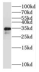 RPL6 antibody|RPL6抗体