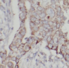 HSP90B1 antibody|HSP90B1抗体 FNa