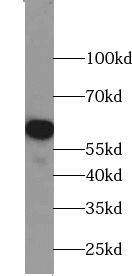 ZBTB22 antibody|ZBTB22抗体