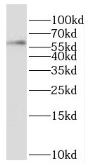 OXSR1 antibody|OXSR1抗体