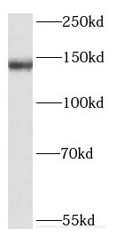 DHX38 antibody|DHX38抗体