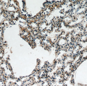 FGD5 antibody|FGD5抗体