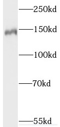 SYNGAP1 antibody|SYNGAP1抗体