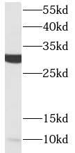ACRV1 antibody|ACRV1抗体
