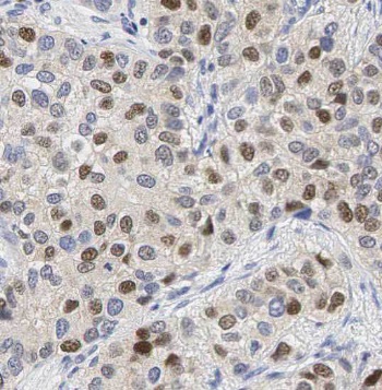 PAK1 antibody|PAK1抗体 FNab06120