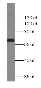 AMY2B antibody|AMY2B抗体