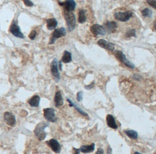 TFE3 antibody|TFE3抗体