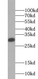 LGALS3 antibody|LGALS3抗体 FNab0