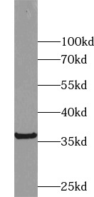 TNFSF13 antibody|TNFSF13抗体