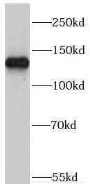 MYO1A antibody|MYO1A抗体