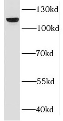 DBN1 antibody|DBN1抗体 FNab02536