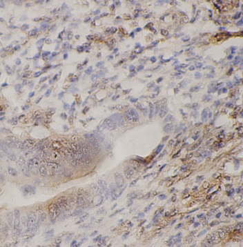 PXN antibody|PXN抗体 FNab10199