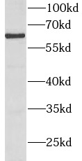 BMPR1A antibody|BMPR1A抗体