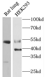CASP12 antibody|CASP12抗体