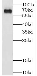 CPNE5 antibody|CPNE5抗体