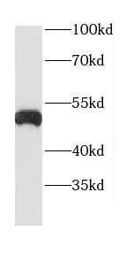 CTSD antibody|CTSD抗体 FNab01306