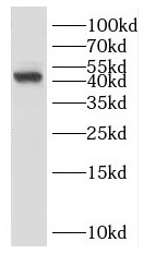 HLA-A antibody|HLA-A抗体 FNab038