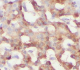 RIPK3 antibody|RIPK3抗体