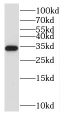 NUBPL antibody|NUBPL抗体