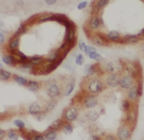 PLK1 antibody|PLK1抗体 FNab10081