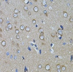 CHRFAM7A antibody|CHRFAM7A抗体