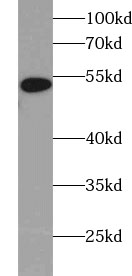 UBR7 antibody|UBR7抗体