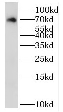 RAB11FIP5 antibody|RAB11FIP5抗体