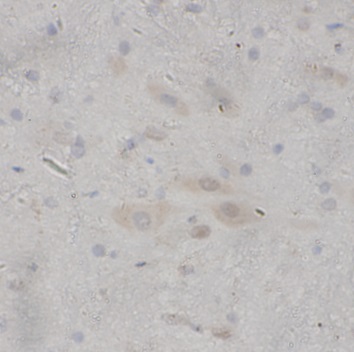 NEUROD1 antibody|NEUROD1抗体 FNa