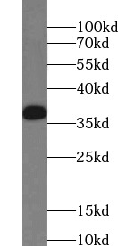 PCNA antibody|PCNA抗体 FNab06215