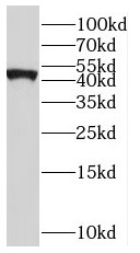 SLC22A18 antibody|SLC22A18抗体