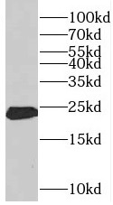 CSH1 antibody|CSH1抗体 FNab06512