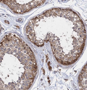 CARD6 antibody|CARD6抗体