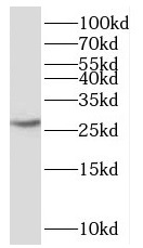 SNRPN antibody|SNRPN抗体