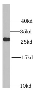 RPL14 antibody|RPL14抗体