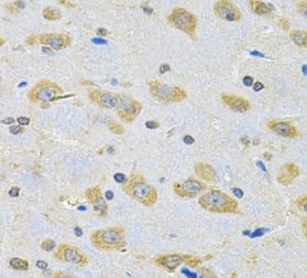 BNIP1 antibody|BNIP1抗体