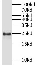 SAR1A antibody|SAR1A抗体 FNab076