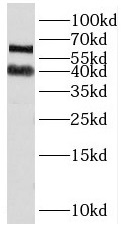 PAIP1 antibody|PAIP1抗体