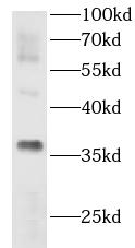 AKR1E2 antibody|AKR1E2抗体 FNab0